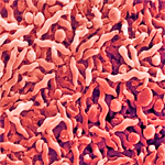 Campylobacter jejuni 