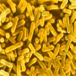 Legionella - Legionnaires’ disease