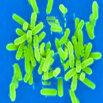 Pseudomonas - Pseudomonas aeruginosa