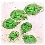 Giardiasis under microscope